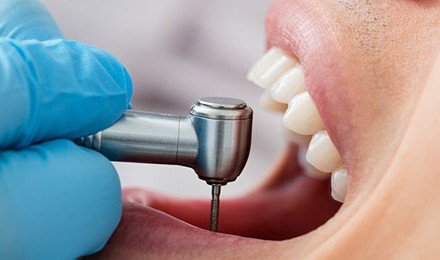 Restorative Dental